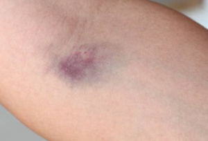 Mėlynė