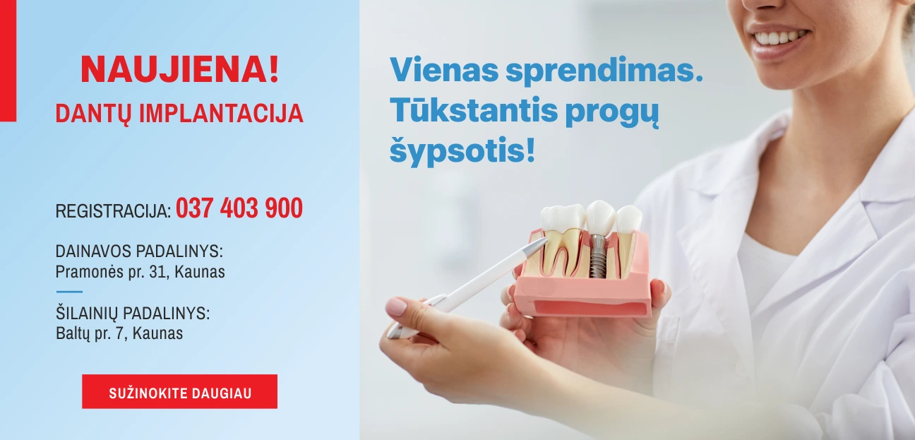Dantų implantavimas